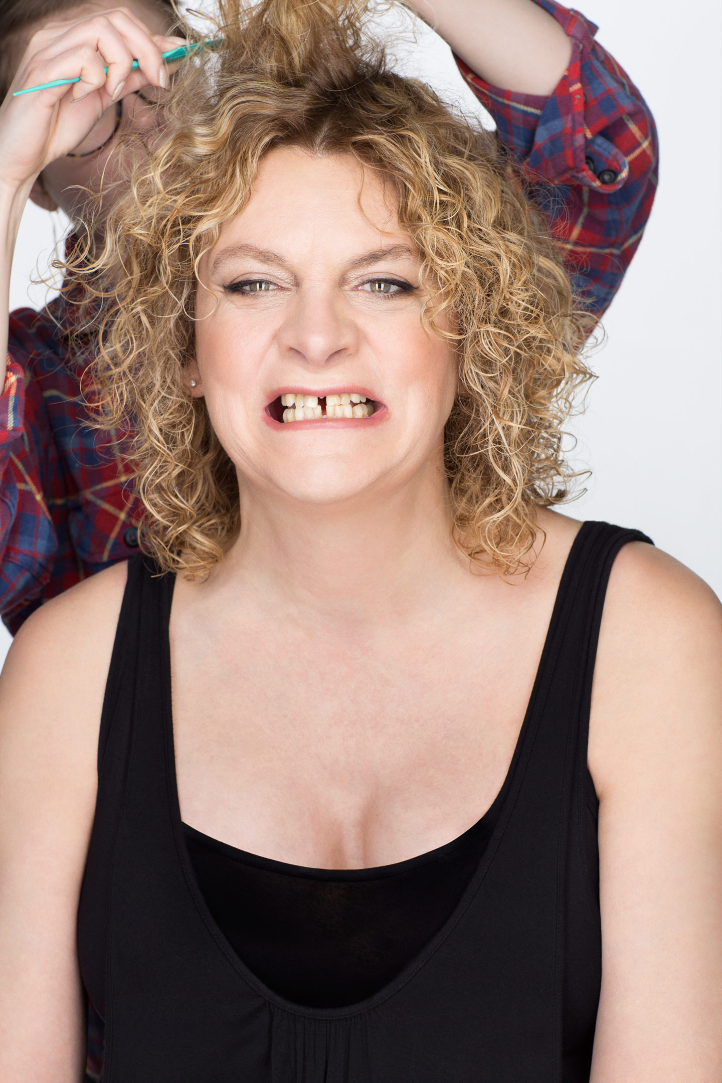 Dents de Michelle Blanc avant traitement